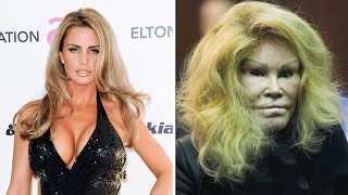 Before and after plastic surgery  Jocelyn Wildensteins Cosmetic Disaster 1 [upl. by Margot]