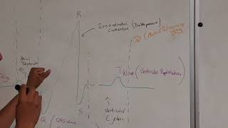 Looking at an Electrocardiogram 📈🫀 [upl. by Folsom]