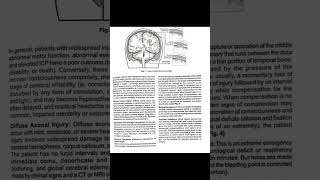 Types of head injury and nursing management of craniotomynursingcraniotomynursing management [upl. by Hosfmann]