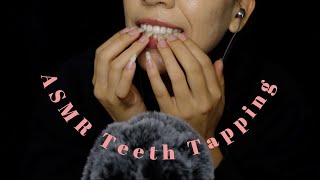 ASMR Teeth Tapping with Long Natural Nails [upl. by Aineg]