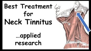 Best Treatment for NeckTinnitus  Somatictype [upl. by Huesman168]