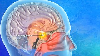 Endoscopic Transsphenoidal Pituitary Surgery Explained [upl. by Aker]