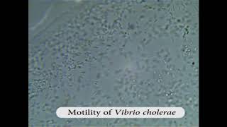 Motility of Vibrio cholerae [upl. by Gowon]