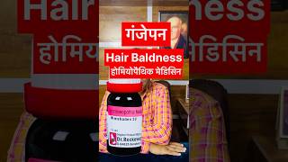 गंजापनhair fallbest homeopathy medicine Hair fall homeopathicmedicinehairbaldness [upl. by Adelheid]