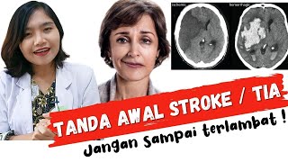 Gejala Awal Sakit Stroke TIA  Kenali sebelum Terlambat   dr Ema Surya P [upl. by Marshal]