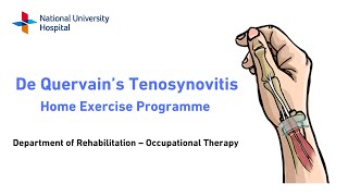 Management of De Quervains Tenosynovitis Home Exercise Programme and Splinting [upl. by Aneema]