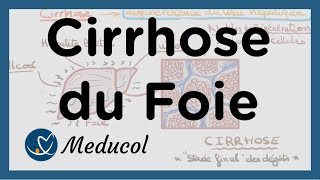 Cirrhose du foie symptômes et fibrose du foie [upl. by Ody978]