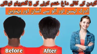 Remove neck darkness in 10 mins at homeکالی گردن کو سفید کرنے کا طریقہ 😱💯 beautytips skincare [upl. by Ley522]