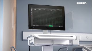 Philips Cardiac Workstation — Tap the power of connected cardiography [upl. by Lladnek]