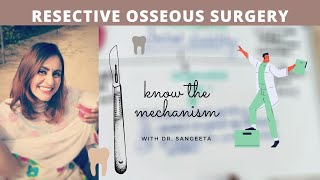 resective osseous surgery in periodontics [upl. by Yalhsa]