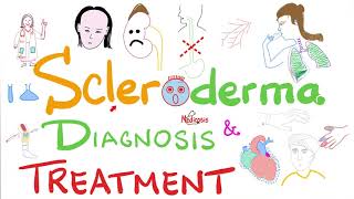 Scleroderma Diagnosis and Management [upl. by Yentruocal]