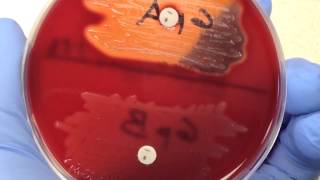 Microbiology  Bacitracin [upl. by Ern693]