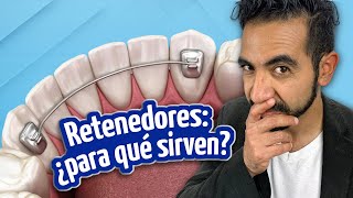 Retenedores después de los brakets ¿Cuánto tiempo y por qué deberías usarlos [upl. by Annairol456]