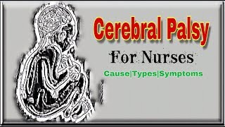 Cerebral Palsy  Causes  Types  Nurse  Lo Gyan Lo [upl. by Notlrahc806]