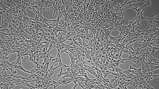 NIH 3T3 cells growth by using JuLI Br 65 hrs [upl. by Carberry]