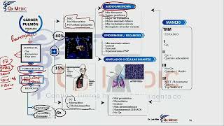 7 MAPA MENTAL NEUMOLOGÍA CÁNCER DE PULMÓN [upl. by Ardnued]