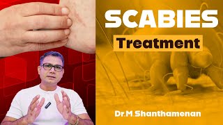 Treatment for Scabies தமிழ்  DrShanthamenan scabies treatment healthy healthylifestyle [upl. by Ahsiet]