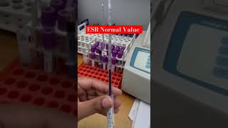 ESR Erythrocyte Sedimentation Rate🩸 Infection blood  ESR infection paramedical [upl. by Ahsiea]