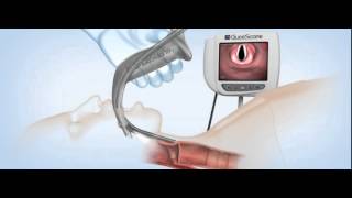 GlideScope Titanium Video Laryngoscopes Demonstration [upl. by Averi573]