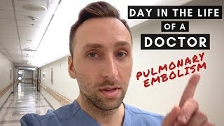 Day in the Life of a DOCTOR Radiologist Hospital VLOG Pulmonary Embolism [upl. by Haida]