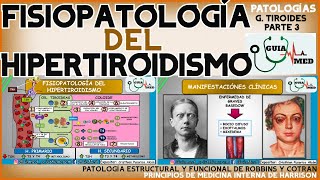 HIPERTIROIDISMO FISIOPATOLOGÍA  GuiaMed [upl. by Ennahteb]