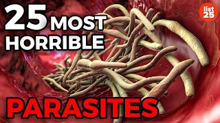 25 Parasites You Do Not Want To Be Infected With [upl. by Burg]