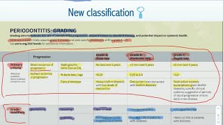 New periodontal classification for SDLE by Saud Alqahtani [upl. by Jamima]