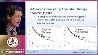 Management of appendiceal cancers From pathology to treatment [upl. by Aliahkim279]