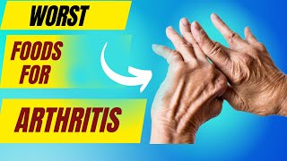 Foods to avoid with arthritis Anti inflammatory diet for arthritis  Arthritis causes food [upl. by Anikes818]