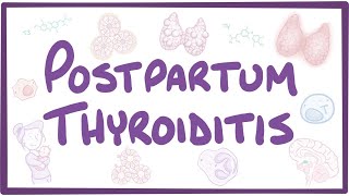 Postpartum thyroiditis  causes symptoms diagnosis treatment pathology [upl. by Nnaitak464]