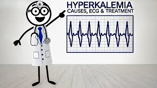 Hyperkalemia Explained Causes ECG Symptoms amp Treatment  ICU Essentials [upl. by Signe727]