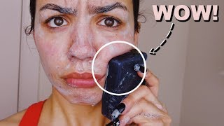 I Used Charcoal Black Soap On My Skin Everyday For One Week [upl. by Logan569]