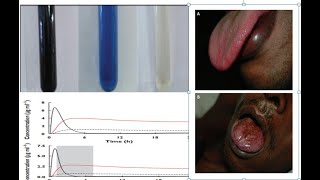 PARAQUAT POISONING  MANAGEMENT [upl. by Anner539]