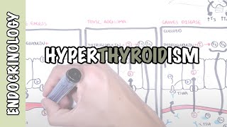 Hyperthyroidism Overview causes pathophysiology [upl. by Rednasyl]