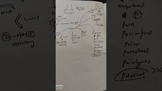 Supracondylar fracture neetpreparation orthopedics [upl. by Ikik12]