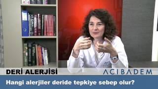 Hangi alerjiler deride tepkiye sebep olur [upl. by Ysiad765]