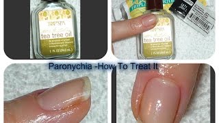 Acute Chronic PARONYCHIA Treatments [upl. by Fine]