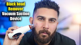 How To Use Blackhead Remover Vacuum Suction Device  Remove Blackheads  Acne Pimple Cleaner Vacuum [upl. by Loma]