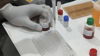 TPHA test procedure [upl. by Olegnaleahcim690]