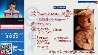 Otorrinolaringología Fundamentos teóricos rinitisepistaxis parálisis facial  QXMEDIC 2022 [upl. by Zerimar]