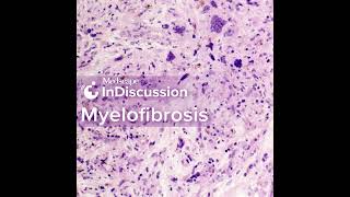 What Does the Future Look Like for Myelofibrosis [upl. by Wartow]