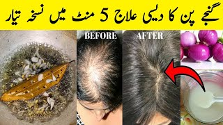 Stop hairfall with onion black seedkalonji fenugreek seedsHair growth long hairs [upl. by Annaoi]