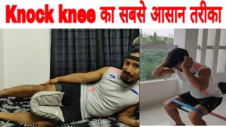 Knock knee को दूर करने का सबसे आसान तरीका। घुटने के दोष से छुटकारा Special force Kapil 9691007672 [upl. by Divad]