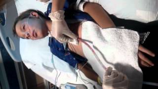 Chest tube removal after open heart [upl. by Eelyrag]