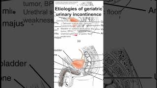 Etiologies of geriatric urinary incontinence [upl. by Nyroc676]