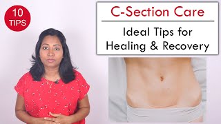 10 Tips to help Heal C Section wound  Post Delivery Care [upl. by Sigismund384]