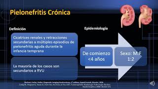 Infecciones y calcificaciones 2021 Módulo Urología [upl. by Itsa906]