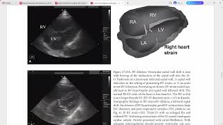 CLINICAL EMERGENCY RADIOLOGY CAMBRIDGE [upl. by Cumine122]