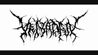 【Veiyadra】 Putrid Infection→Sanguineous Mortuary Brutal Death Metal [upl. by Annahc]