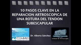 10 Pasos Clave en la Reparación Artroscópica de una Rotura del Tendón Subescapular [upl. by Nelli]